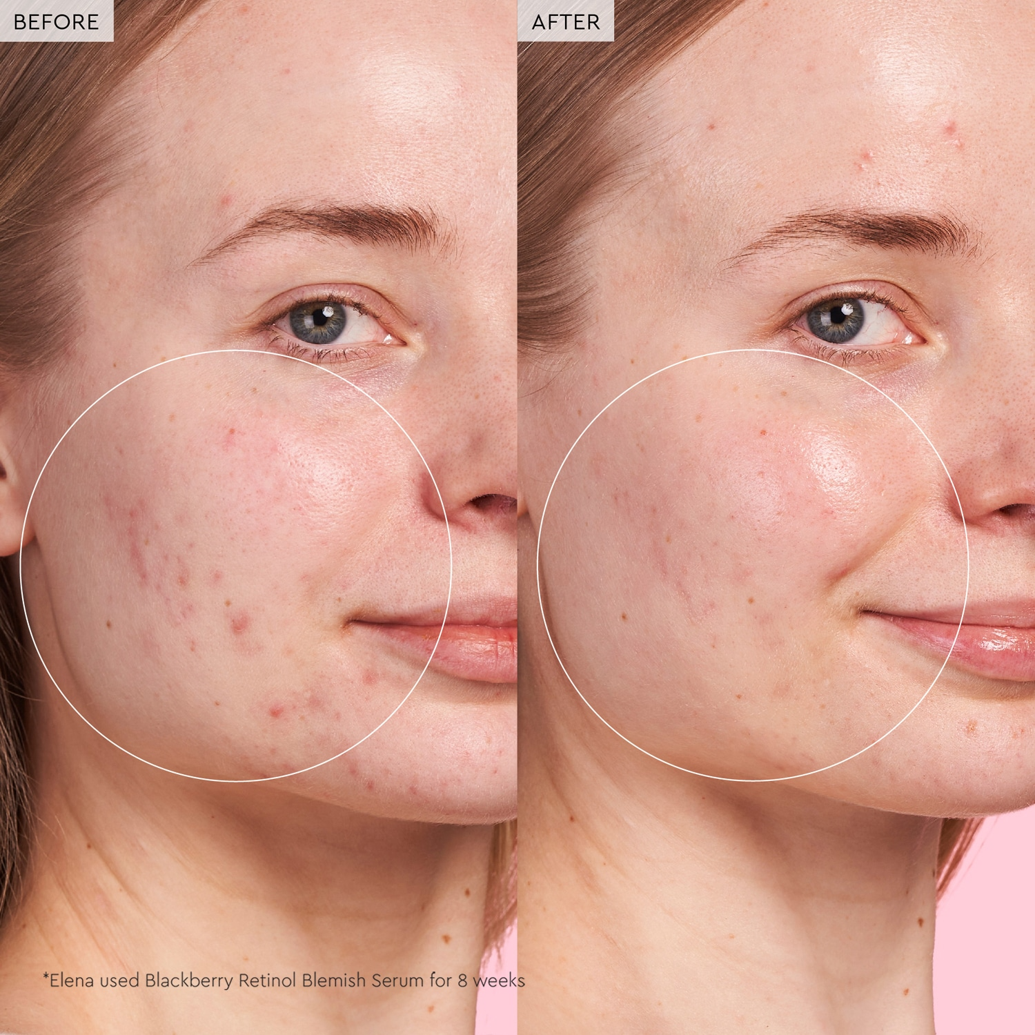 Glow Recipe Blackberry Retinol - Blemish Serum