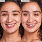 Glow Recipe Blackberry Retinol - Blemish Serum