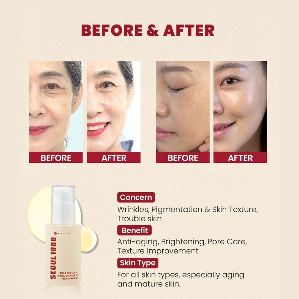 KSECRET SEOUL 1988 Cream : Retinal Liposome 1% + Fermented Rice