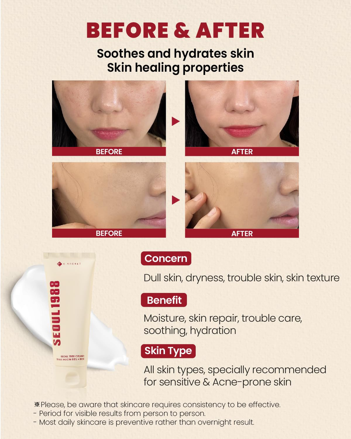 KSECRET SEOUL 1988 Cream: Snail Mucin 93% + Rice