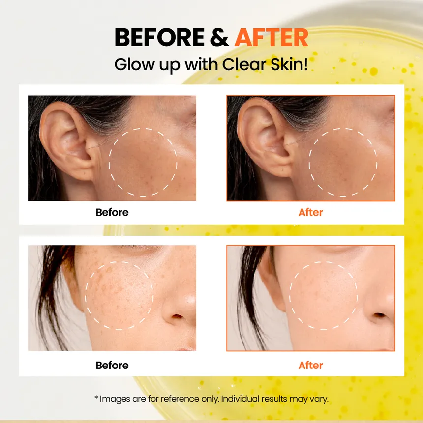 KSECRET SEOUL 1988 Glow Serum: Niacinamide 15% + Yuja